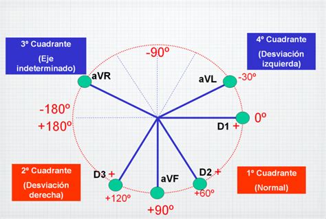Eje Cardíaco Como calcular el Eje Cardíaco en el EKG paso a paso.